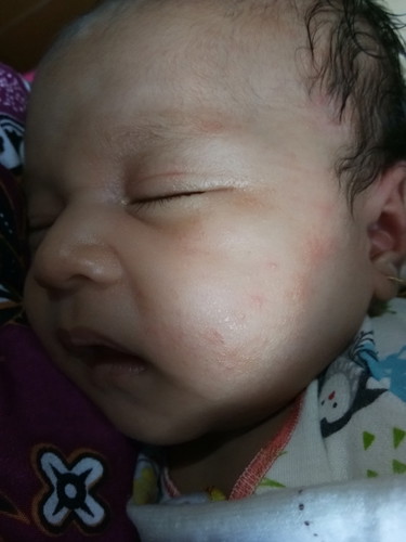 pipi merah