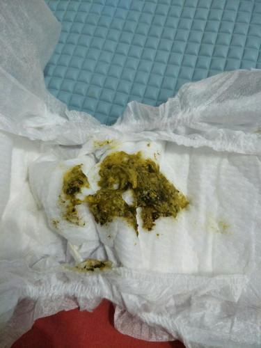 pup bayi ( jgn dibuka jika jijik)