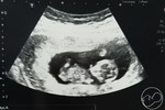 ลูกน้อยของแม่ profile icon