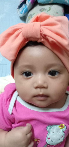 ลูกสาวเป็นไตโป่งพอง ตอนนี้อายุ2เดือน3วัน