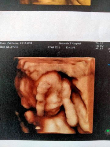 Patchanee profile icon