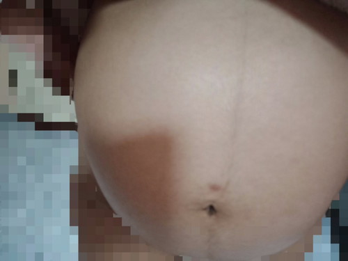21+3สัปดาห์ 5เดือนนิดๆ กำหนดคลอด 2 พฤศจิกายน 62