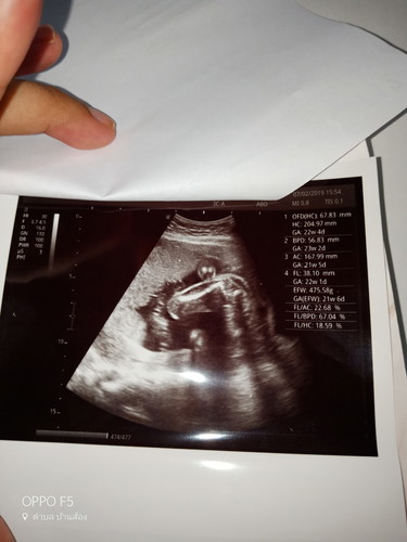 ดูน้ำหนักลูกกับความยาวตัวลูกตรงไหมคะ