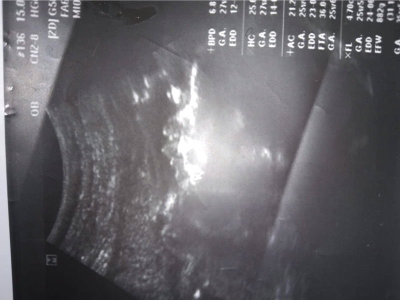 อินทิรา ขวาคำ profile icon