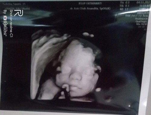 Thallia Theresia profile icon