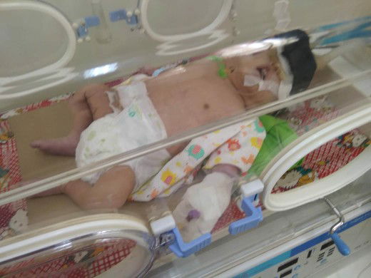 kehamilan pertamaku gagal