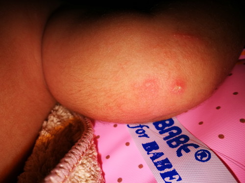 ลูกเป็นตุ้ม