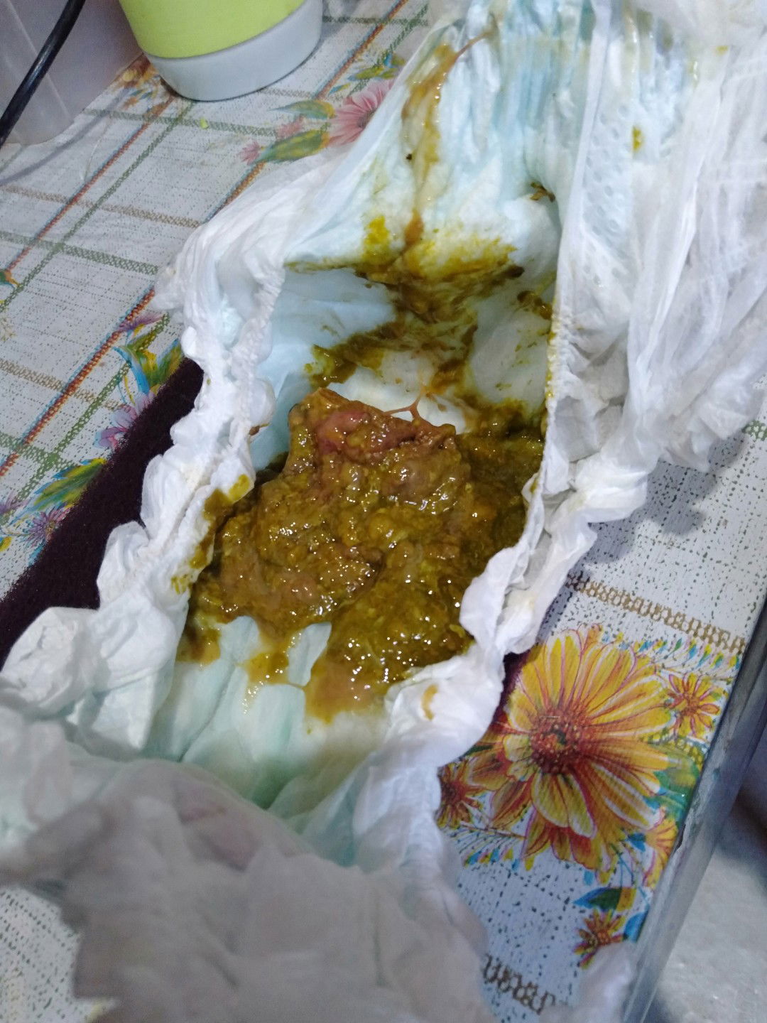 could this be diarrhea or amoebaiasis???