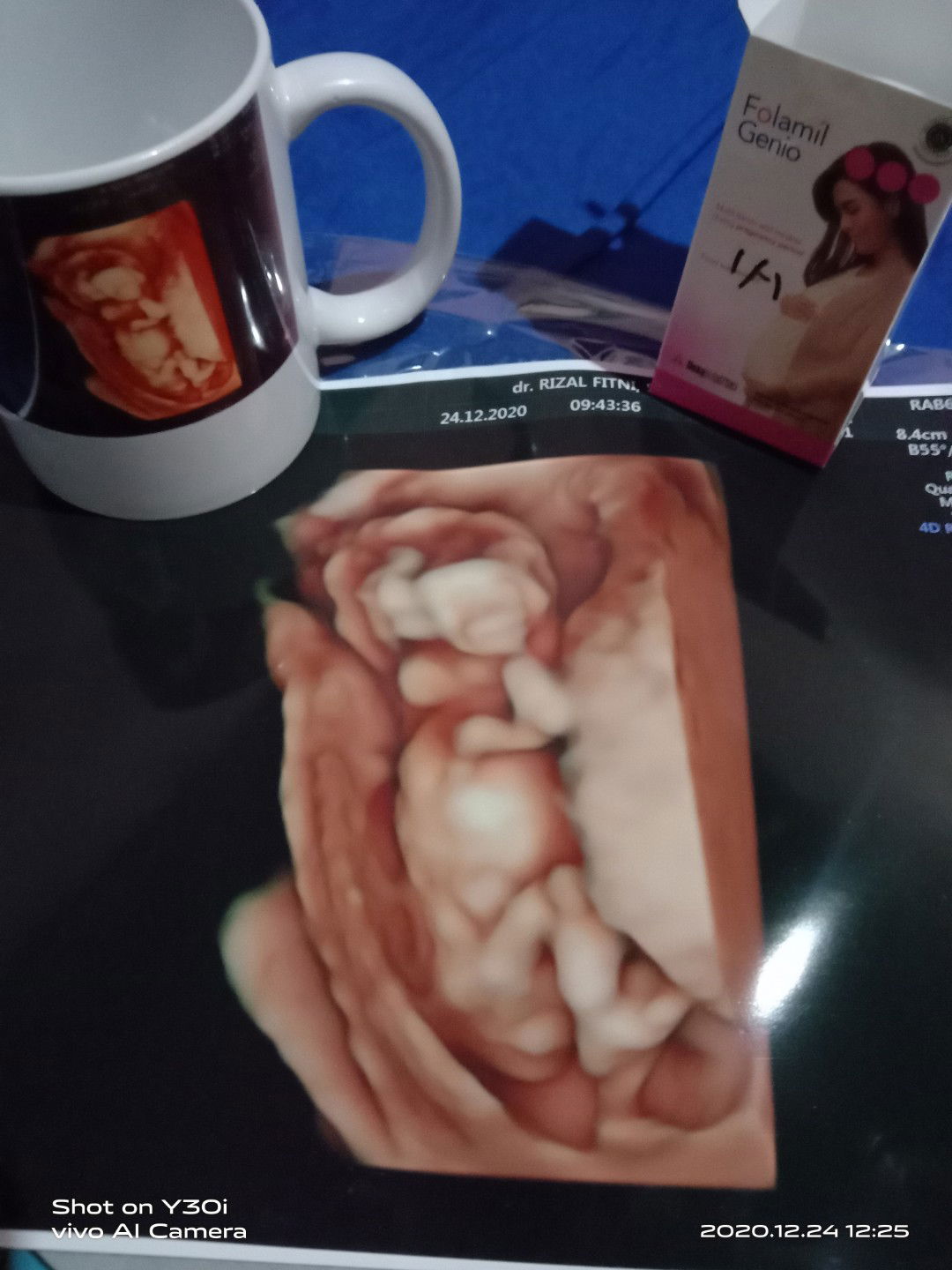 Yeni Risma profile icon