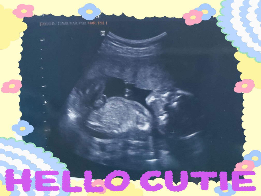 อรวรรณ อุทัยบาล profile icon