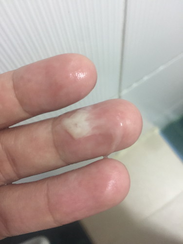 แบบนี้ใช่มูกใสไหม๊คะ 37w5d