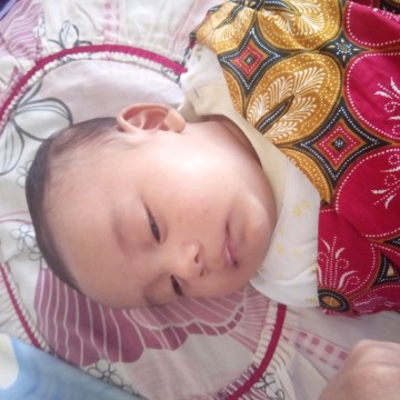 Seperti jerawat