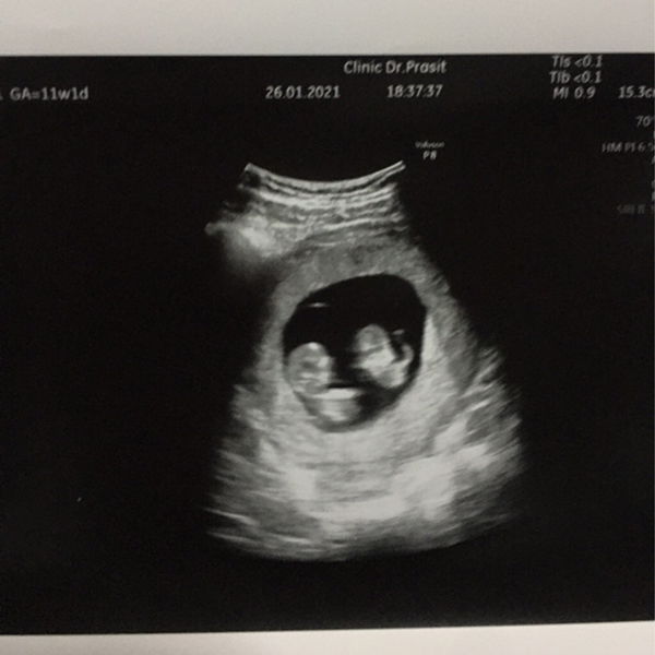 Wachiraporn Thongsen profile icon