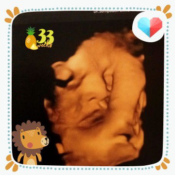 MyloveisU profile icon