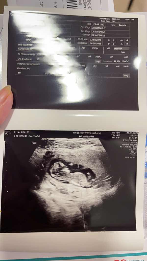 Lalada Srikongmueang profile icon