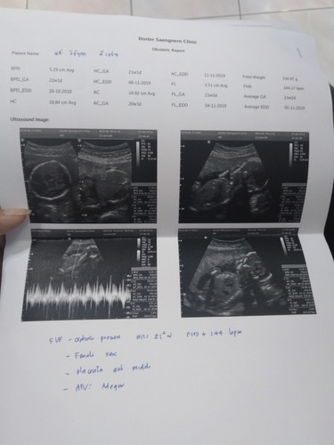 21w 6d