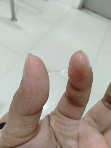 มีเมือกใสๆ