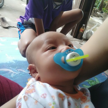 ให้ลูกดูดจุ๊กนมมีข้อดีข้อเสียอย่างไรบ้างคะ