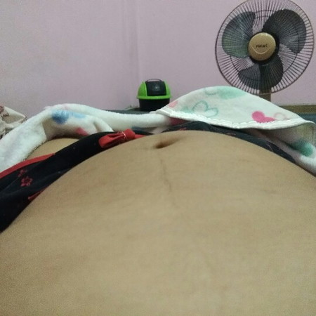 ท้องเบี้ยว