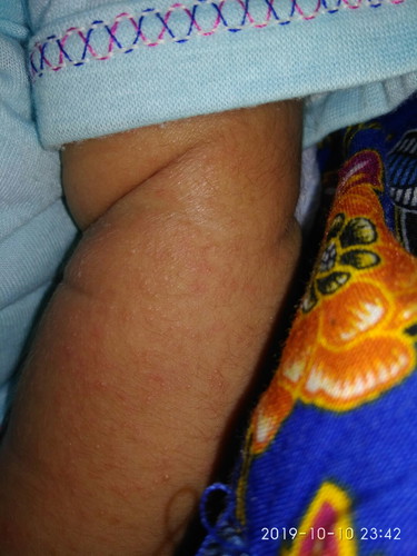 kulit bayi