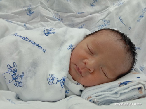 คลอดก่อนกำหนด