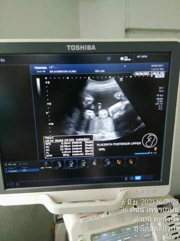 Sunita Sanlee profile icon