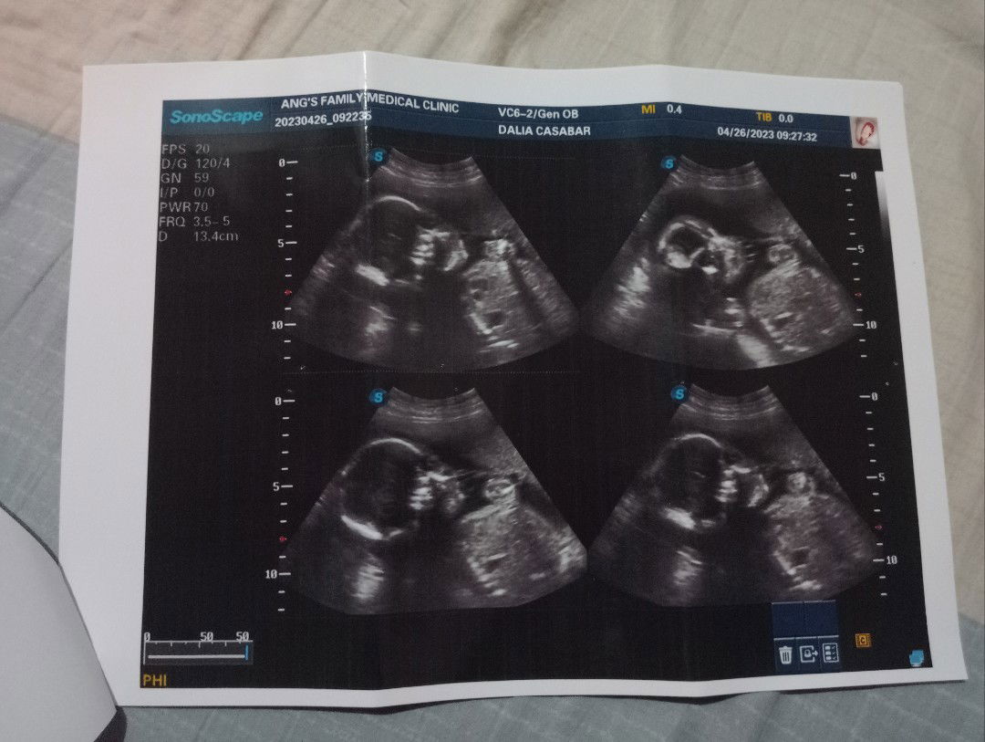 franz  Dale Casabar lapizar...?? profile icon