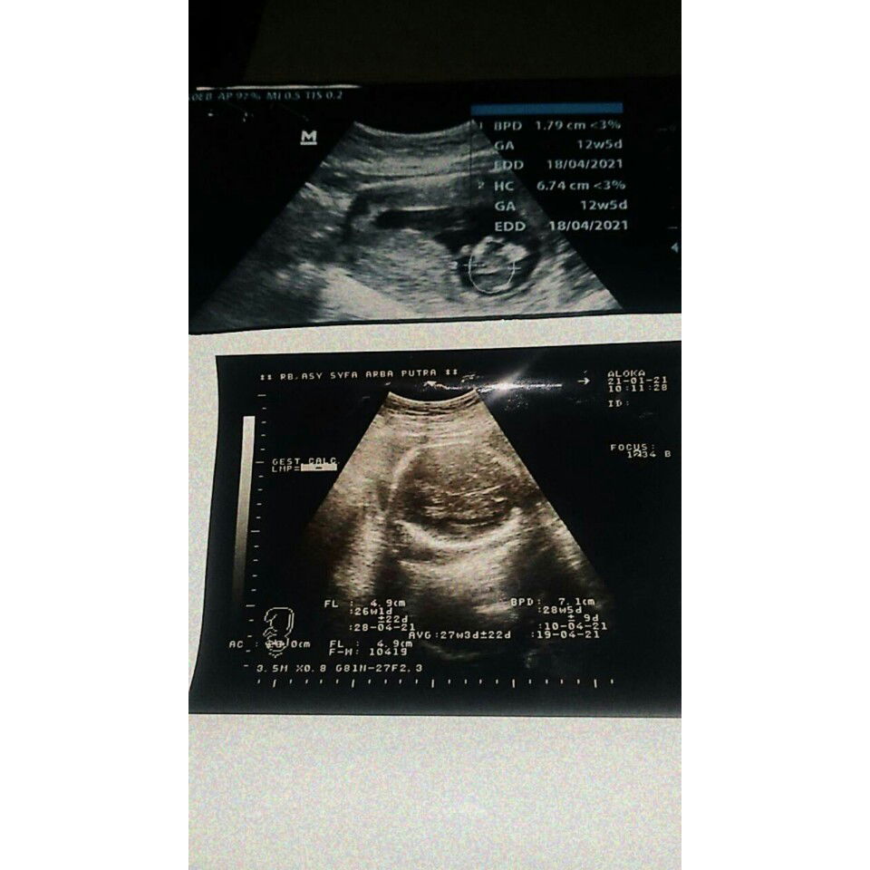 N Mira Aprlya profile icon