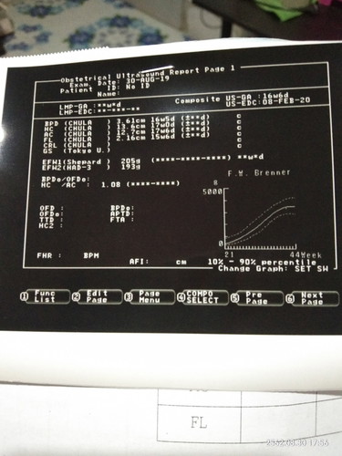 น้ำหนักลูก