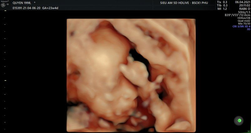 Lê Quyên profile icon