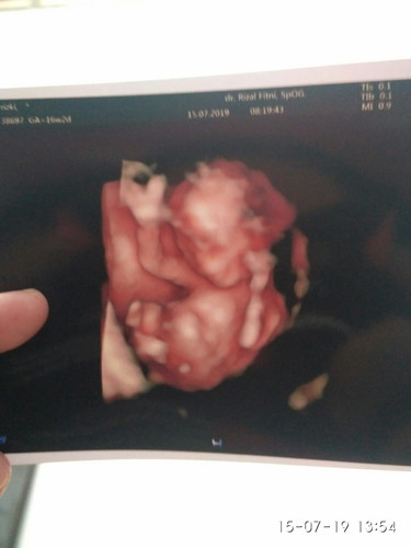 16 wk