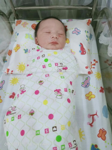 Indikasi SC karena CPD