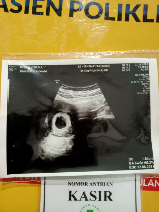 Hani Veneska profile icon