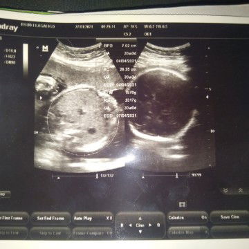 Wardahsnrti profile icon