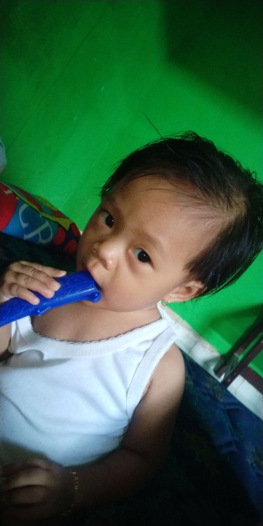 kantung mata pada anak