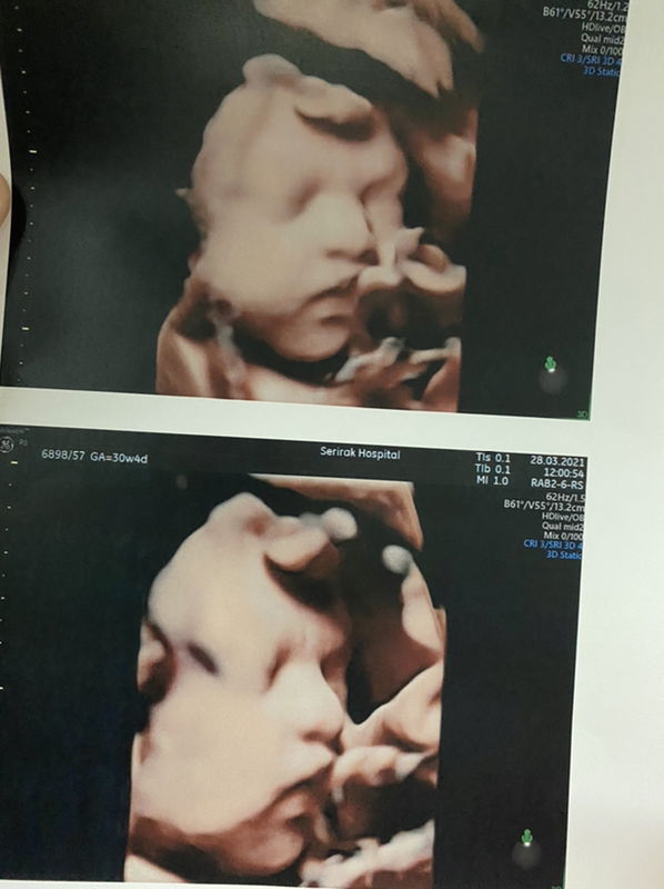 Nทิกเกอร์ครับ profile icon