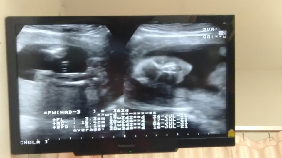 Oiw Sudarat profile icon