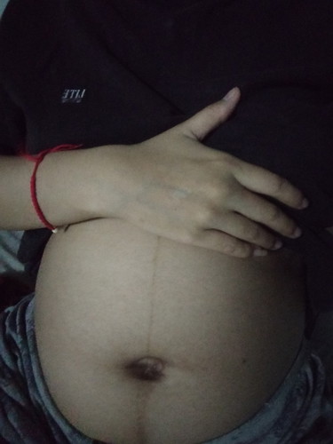 ท้องแบบนี้จะได้หญิงหรือชาย เดาเล่นๆ ก่อนไปซาวด์จริงนะคะใคร ?