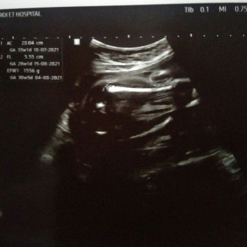 29w แม่ๆดูออกไหมคะเพศอะไร