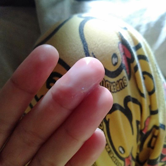 แบบนี้เปนอะไรไหมคะ