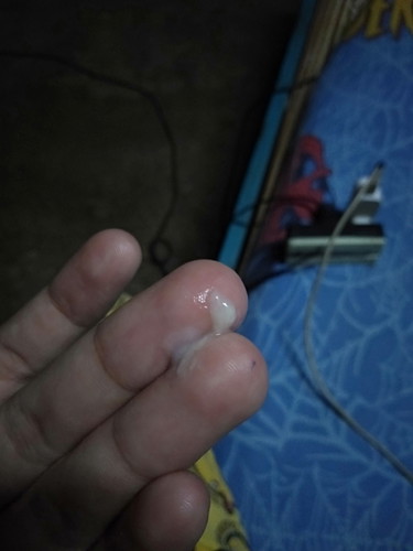 ตกขาวหรือมูก38+3