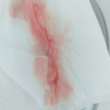 Bolak Balik pembukaan