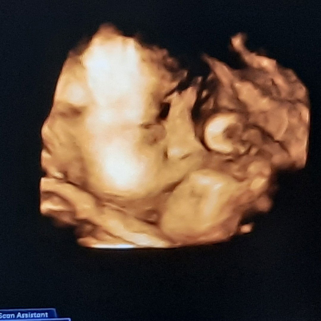 Rere Auza profile icon