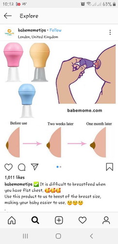 inverted nipple