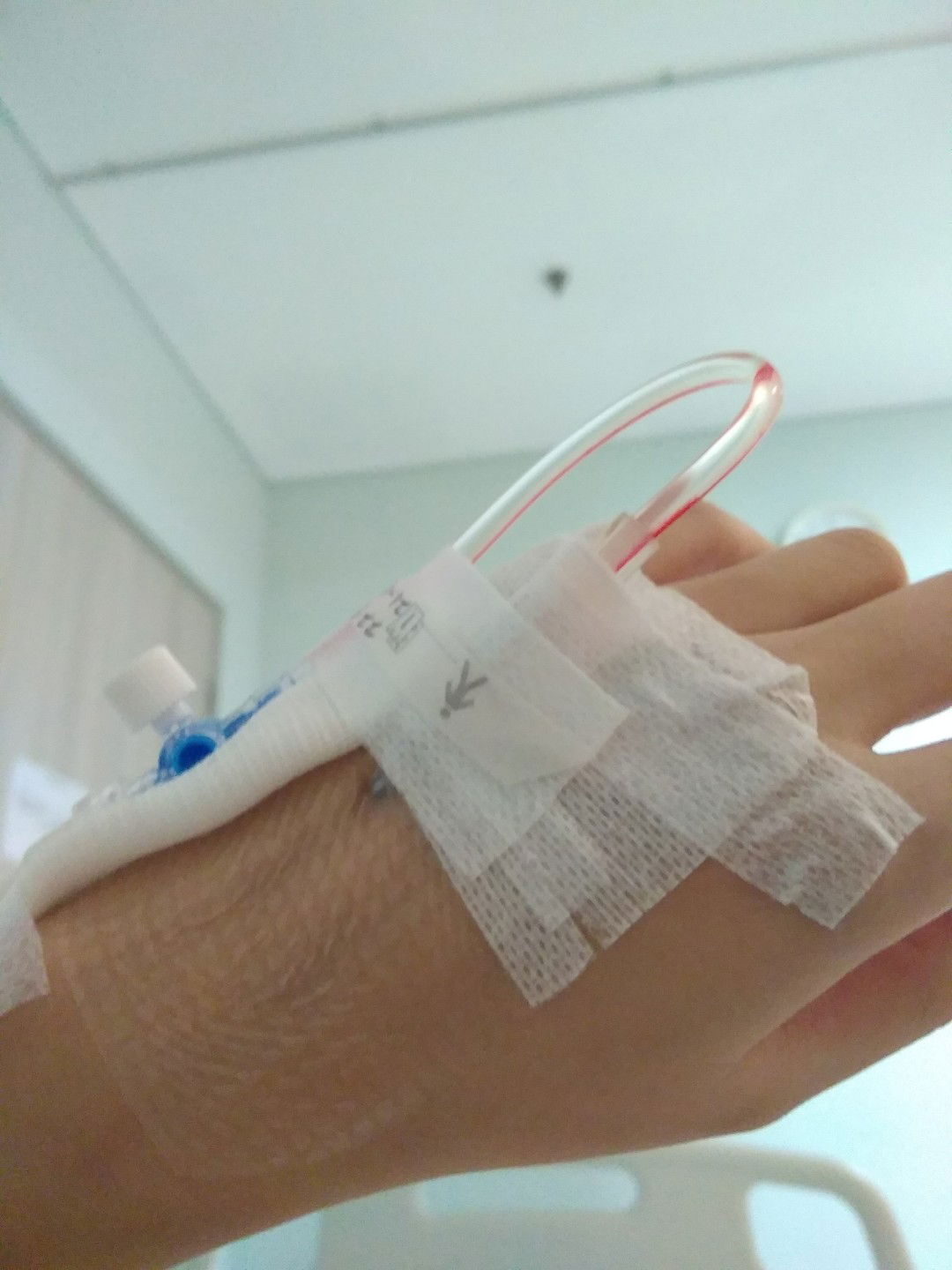 ISK Berulang Dan Kontraksi 27 Minggu