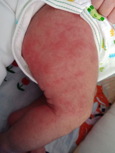 สอบถามแม่ๆค่ะ