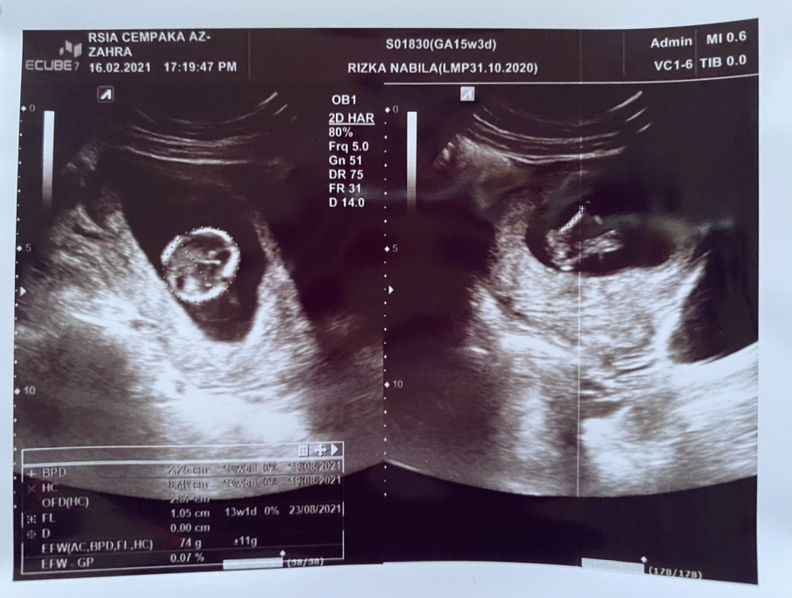 Riska Nabila profile icon