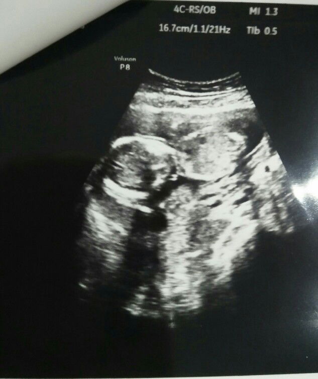 เมษา profile icon