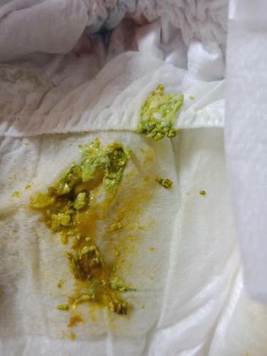 แบบนี้ปกติไหมค่ะ