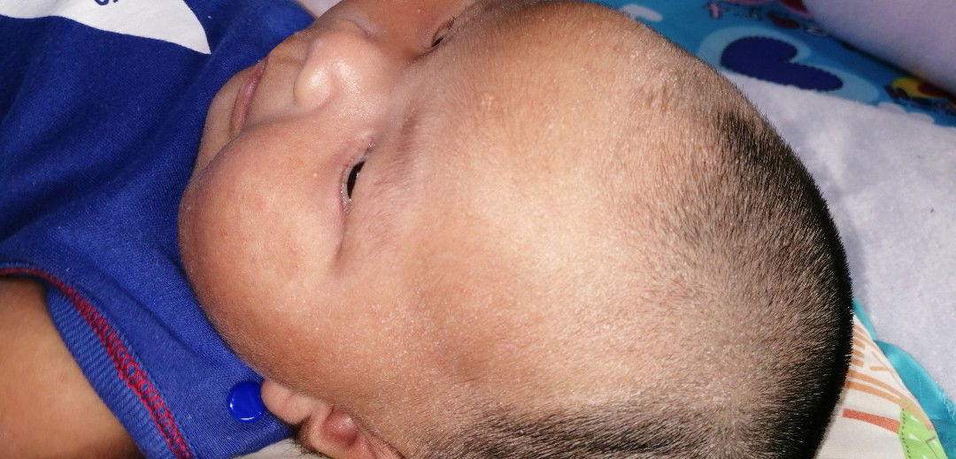 ผิวเด็ก